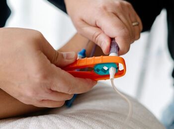 A nurse uses an orange Yewtwist to loosen a feeding tube connection