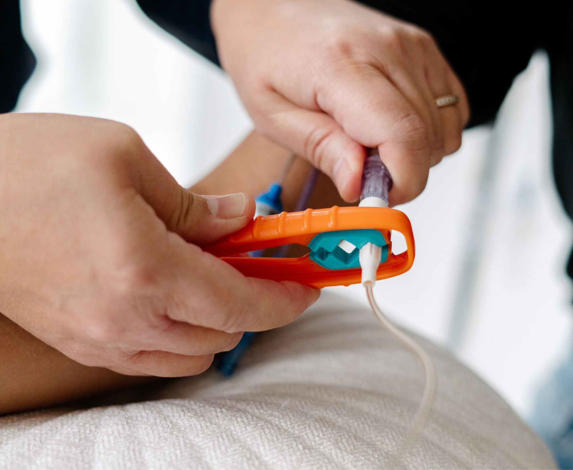 A nurse's hands loosening a feeding tube connection with an orange Yewtwist